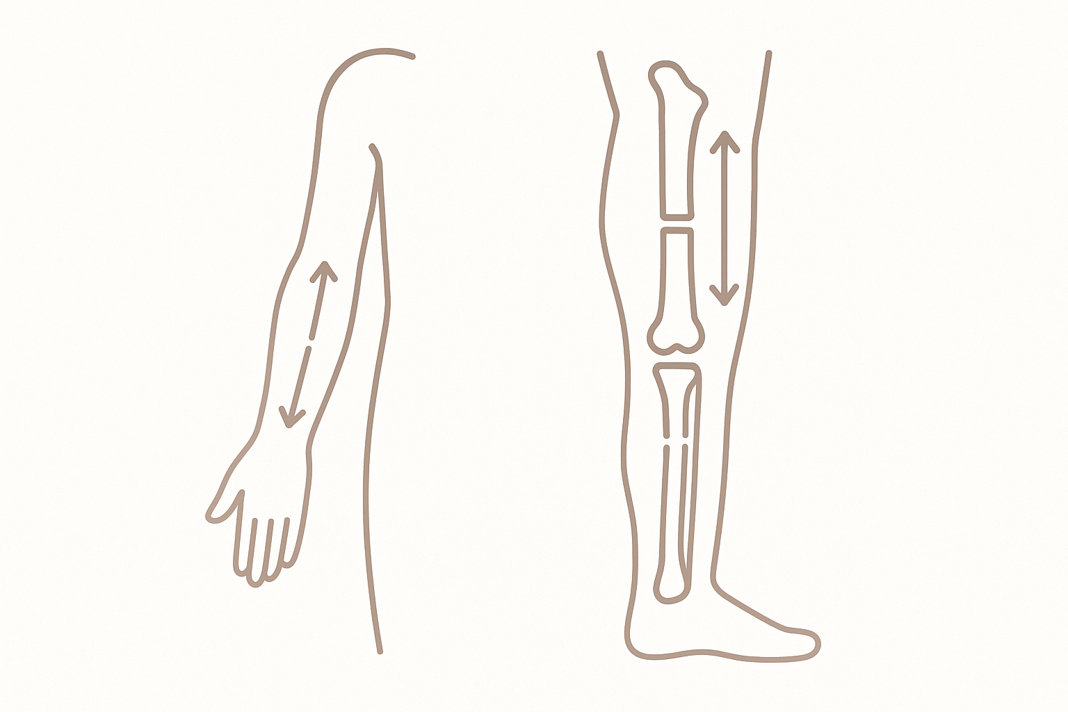 Schematic line drawing of a human arm and leg showing the direction of bone elongation during limb lengthening surgery.